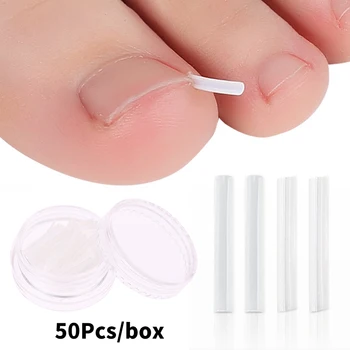 50Pcs врастнал инструмент за корекция на ноктите на краката врастнали нокти лечение еластична кръпка стикер изправяне клип скоба педикюр инструмент