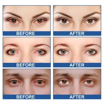 Околоочен крем против стареене подобрява еластичността Грижа за облекчаване на умората Намаляване на очите Намаляване на торбичките под очите, изсветлява под очите 2