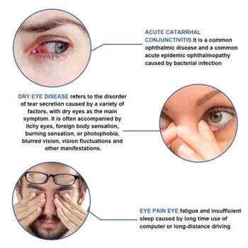 Околоочен крем против стареене подобрява еластичността Грижа за облекчаване на умората Намаляване на очите Намаляване на торбичките под очите, изсветлява под очите 5